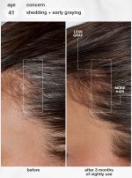 FutureIQ??biomimetic hair longevity serum - Image 3