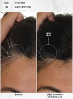 FutureIQ??biomimetic hair longevity serum - Image 4